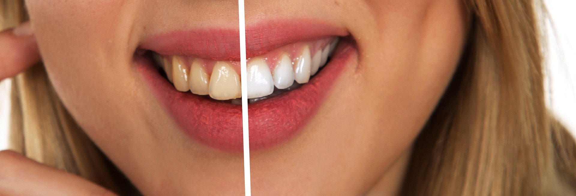 alanya dental,alanya dental center,alanya dental clinic,alanya dentist prices,zahnarzt alanya deutsch,tandlæge alanya priser,alanya dentist gokhan yavuz,alanya zahnarzt,alanya tandlæge,dentist alanya,gokhan yavuz,tandlæge alanya,alanya dental,alanya dental center,alanya dental clinic,alanya dentist prices,zahnarzt alanya deutsch,tandlæge alanya priser